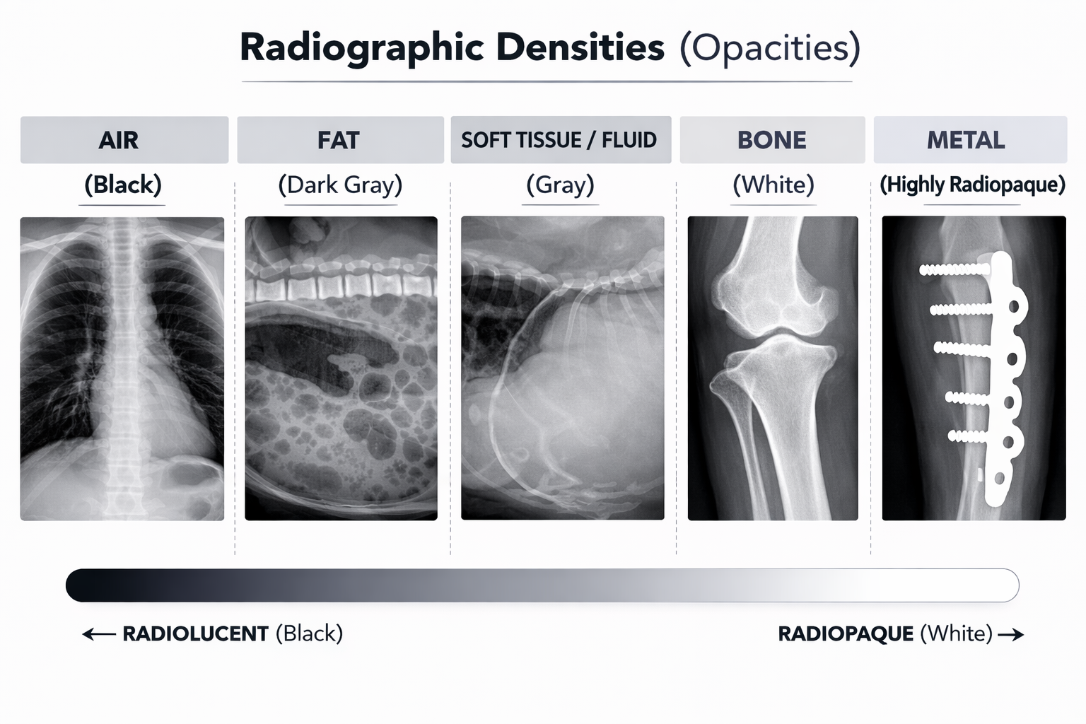 Radiographic density differences: air, fat, soft tissue, bone, and metal