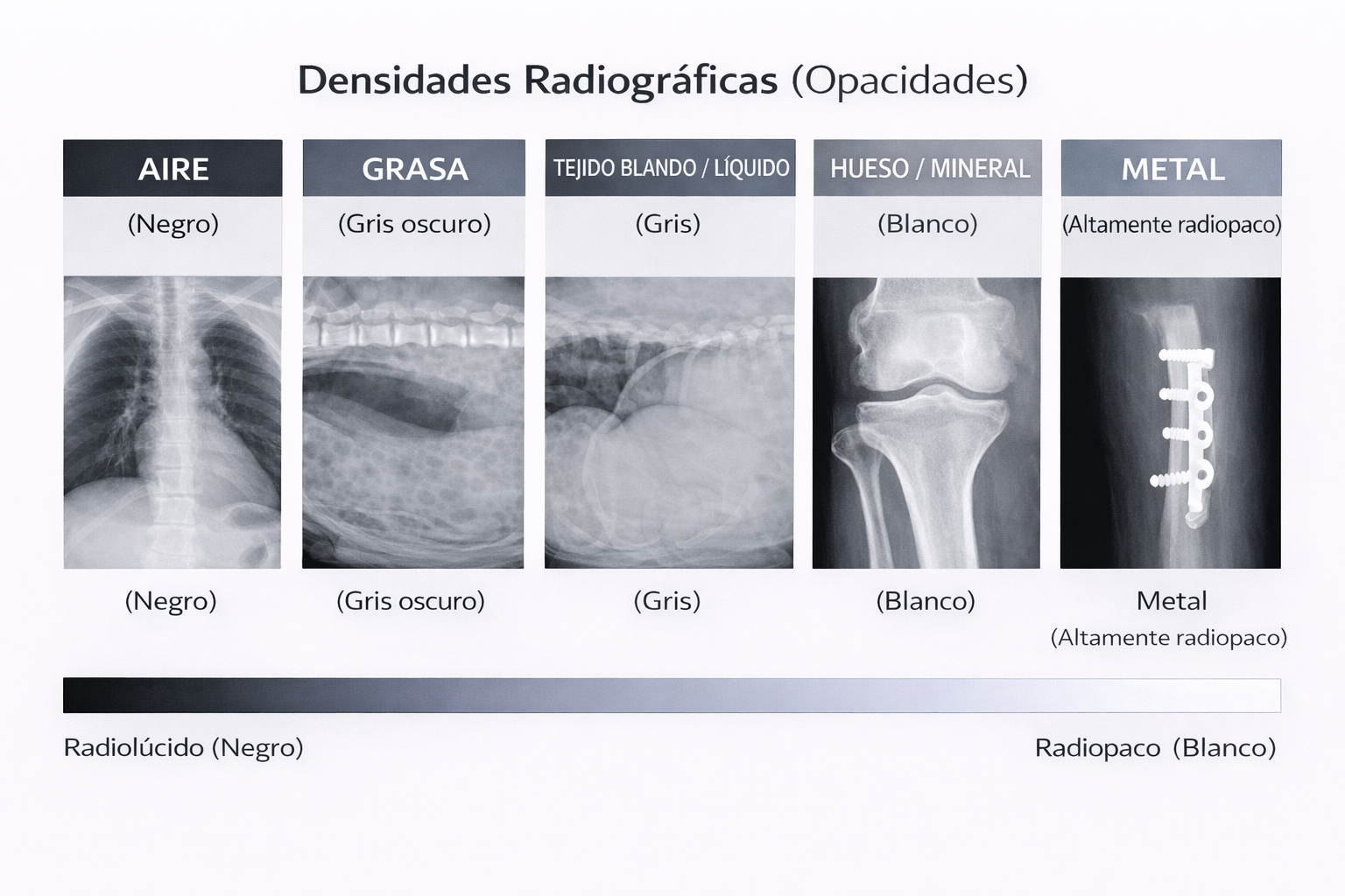 Diferencias de densidad radiográfica: aire, grasa, tejido blando, hueso y metal